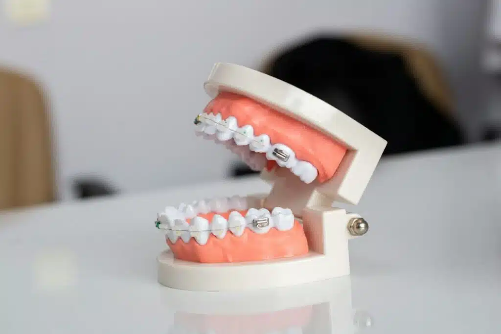 Understanding Your Options: Choosing The Right Orthodontic Treatment At Pco Ceramic Braces