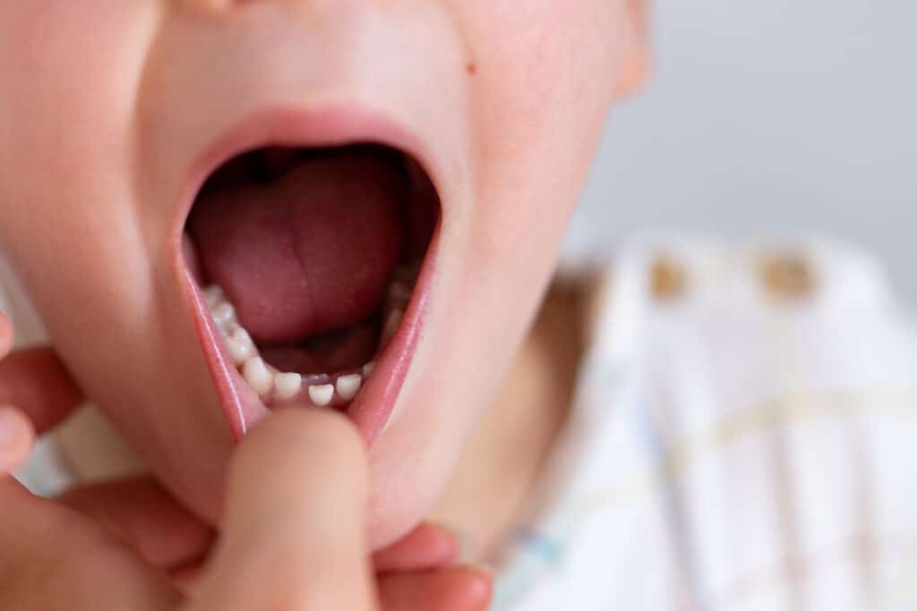 Children Shark Teeth