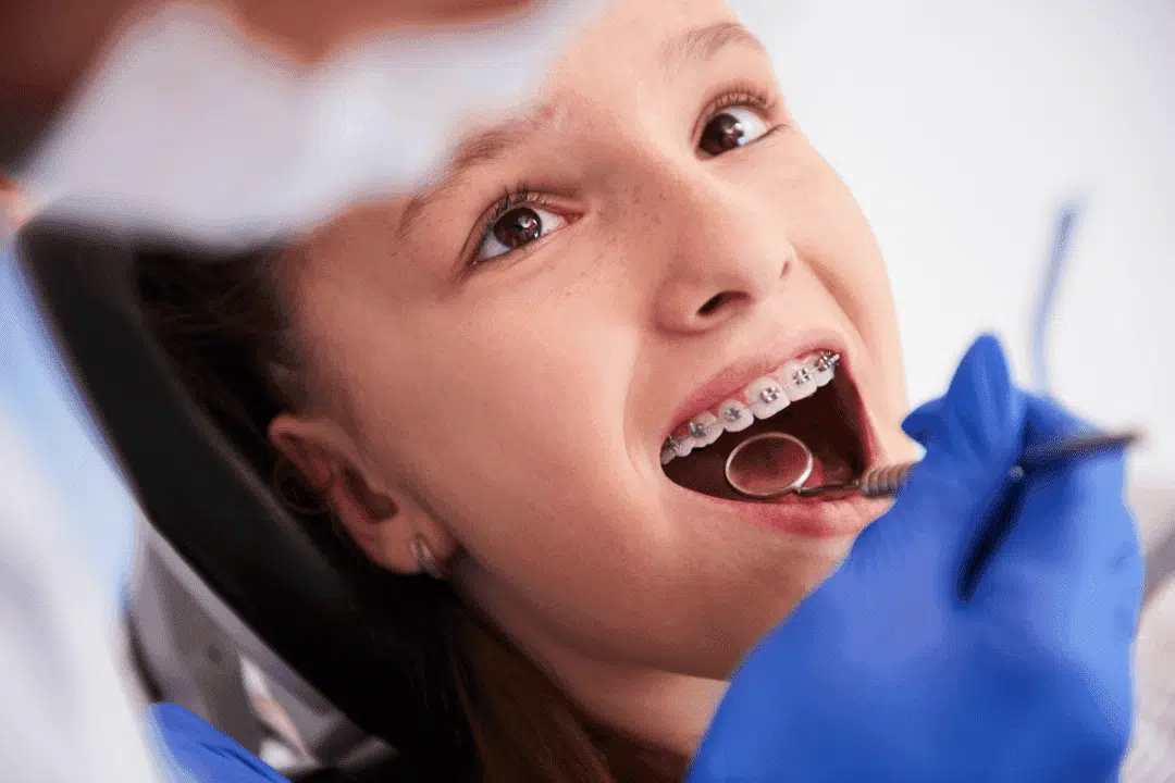 Pediatric Orthodontic Assessment To Determine Braces Timing
